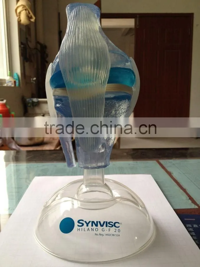 V-AM036 Plastic Human Knee Anatomic Model