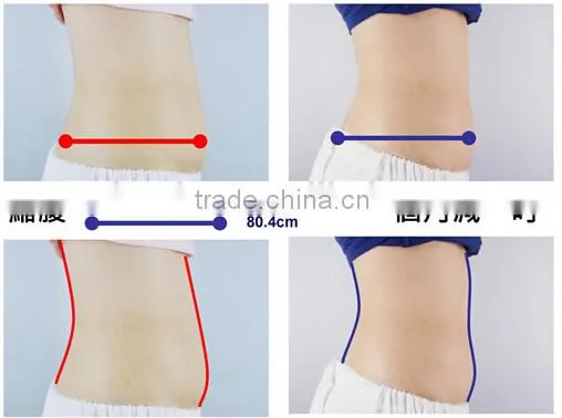 Small Mini Cryo slim freezer weight loss belt BD02