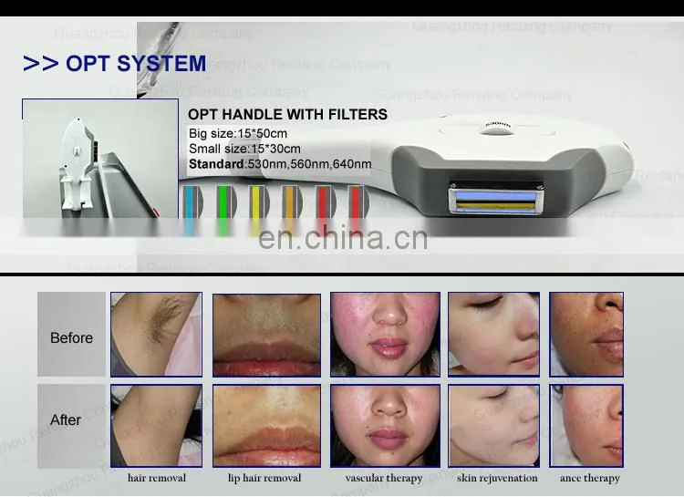 Cheaper Model Ipl Hair Removal Machine for Skin Rejuvenation and Depilation