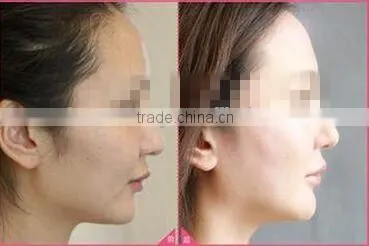 2016 PDT Led/pdt machine/photon led skin rejuvenation