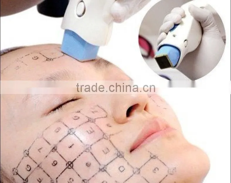Fractional rf microneedle machine