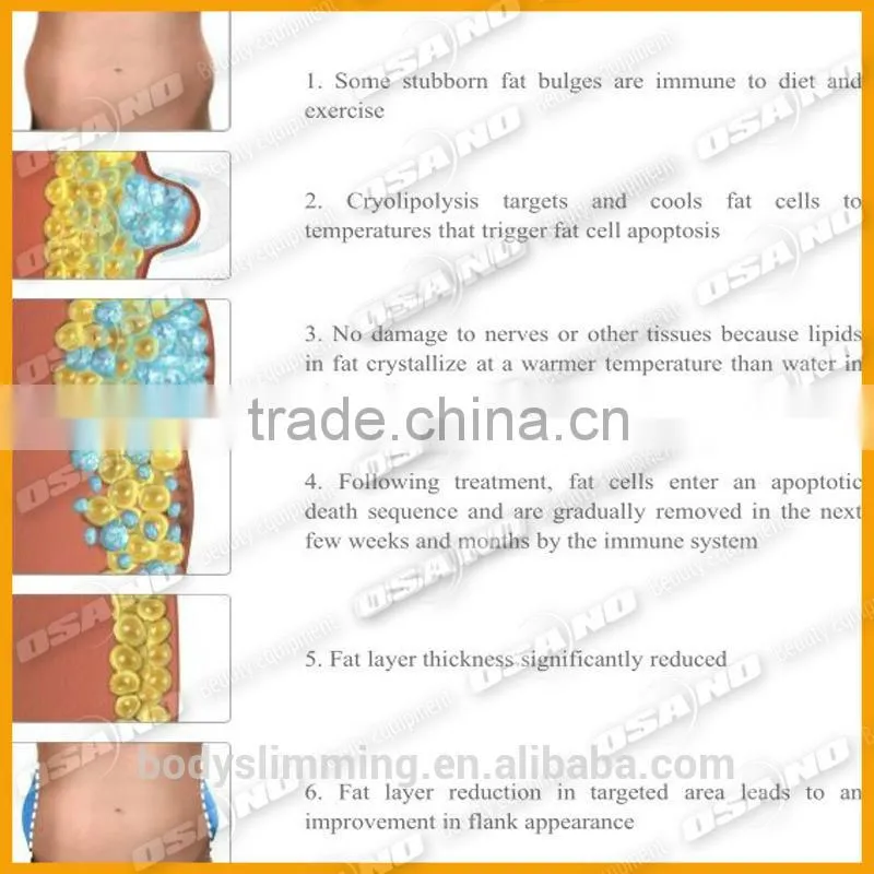 Advanced Slimming Way Cellulite Reduction Criolipolysis Cool Tech Fat Freezing Machine