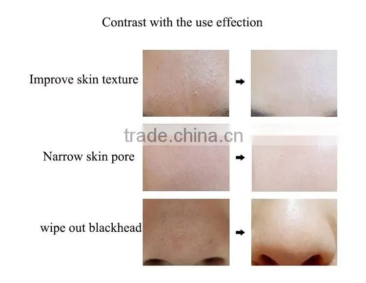 New Arrival Face Brush Facial Cleansing Machine Facial cleanser Korea Pobling Pore Sonic Cleanser 4 Colors