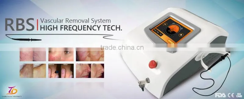 2017 Hot seller Professional Ultrapulse Laser Vein Removal Machine/Vascular Spider Veins Removal