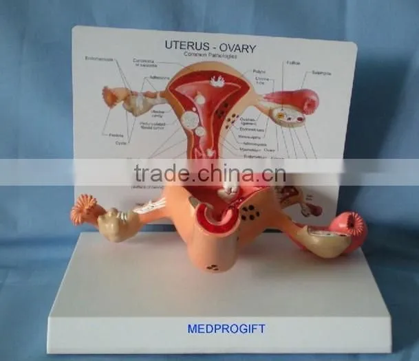 V-AM023 Anatomical uterus ovary care model