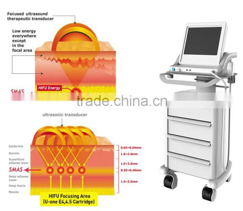 Portable Ultrasound Machine High Quality HIFU Face Lift