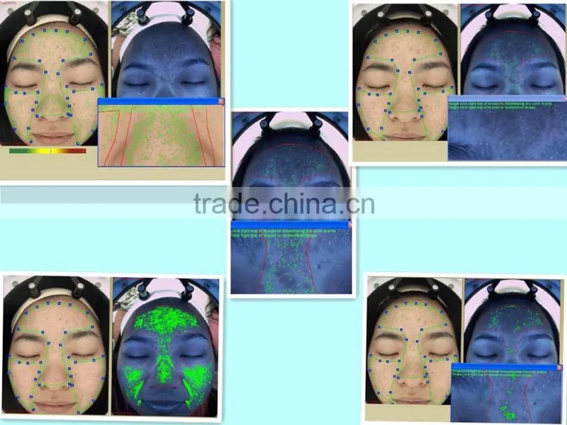 Langdi LD6021C NEWEST Magic mirror facial skin analyzer with CE