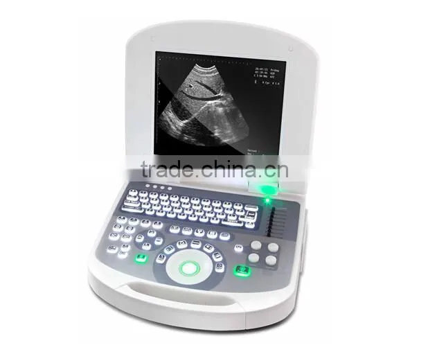 Medical Laptop B mode Ultrasound Scanner RUS-2200 USB 2.0 optional Biopsy Brackets