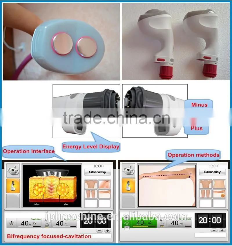 2016 Beauty factory price best cavitation slimming machin