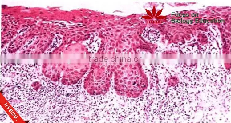 Human oral pathology slides Individual microscope prepared slide