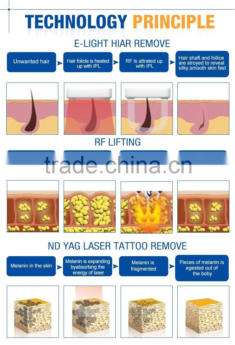 Hair tattoo removal skin rejuvenation IPL 3 in 1 RF machine