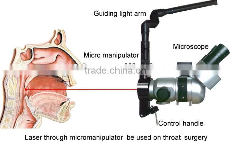 incision tool(CO2 laser equipment)