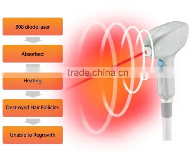 10.000.000 shot full body laser hair removal