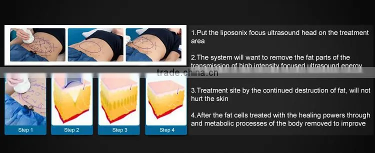 tummy tuck/liposuction without surgery/liposuction surgery