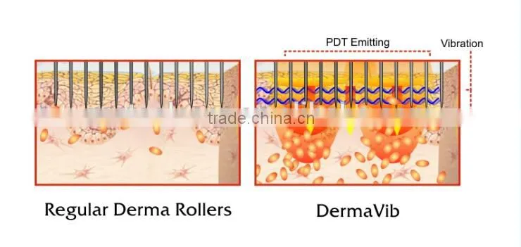 6 in 1 derma roller/ 540 needles Massage LED PDT Derma Vib