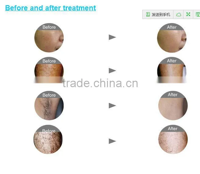 Factory price 808nm diode laser epilation desktop machine with hair removal laser handpiece