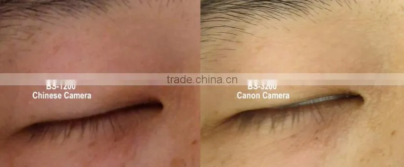 Skin analysis system a-one with pre-set well skin analysis software
