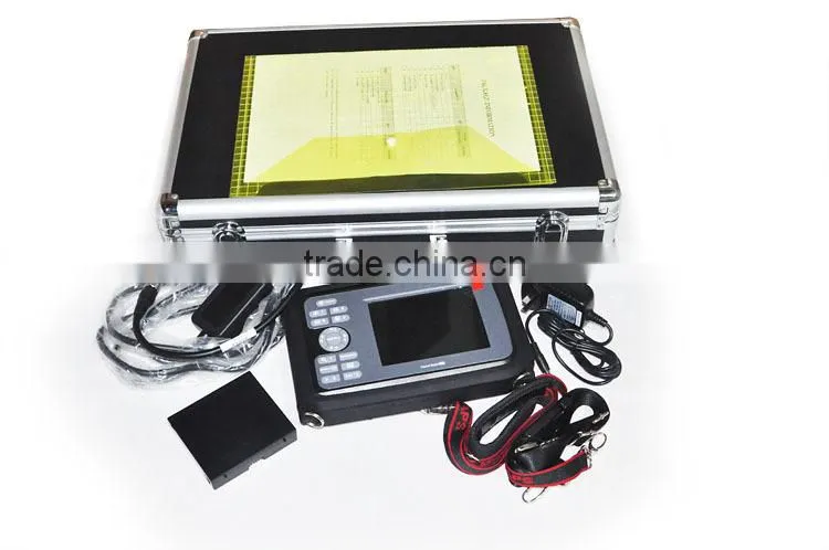 Handheld Digital PalmSmart Veterinary/VET Use Ultrasonic Scanner with Convex Probe-V8