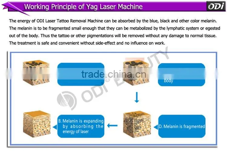 ODI machine manufacturers low laser machine price/beauty skin whitening laser machine