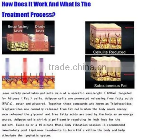 Popuar laser RF slimming machine/ vacuum machine/ cavitation machine for sale