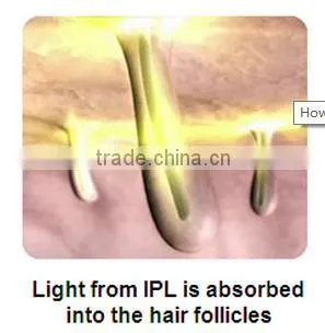 2016 Newest IPL Hair Removal Machine Prices / factory price ipl hand elight