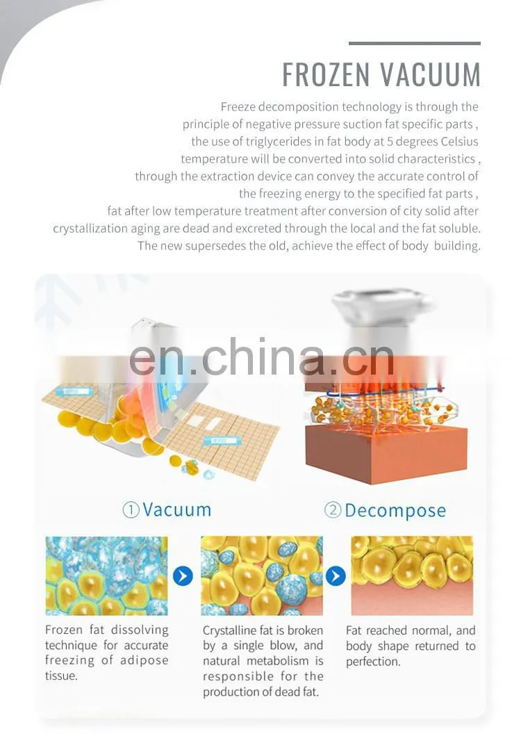 Cryo Body Shape Cryolipolysys 4 Handles 360 cryolipolyses Fat Cell Body Slimming Machine Criolipolisis