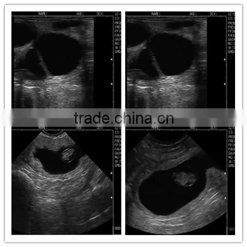 Brand New Ultrasound Machine 3d/4d With High Quality