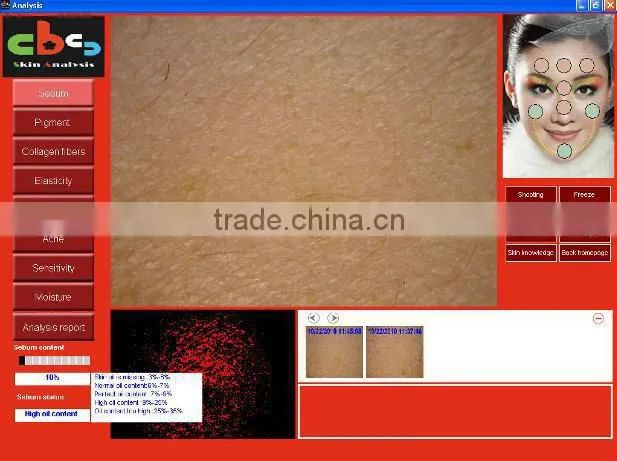 Auto-digital top CBS skin and hair analyzer