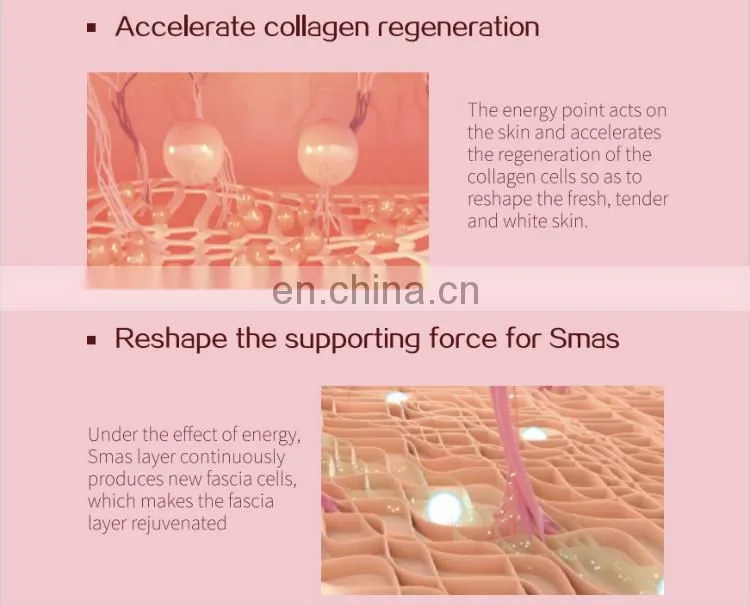 Hello Skin Ultrasound Skin Lifting Anti-Ageing Wrinkle Removal Facial Care