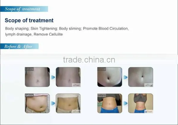 Cryo Sculpture / Slim Freezer Weight Loss / Cool Tech Fat Freezing Machine
