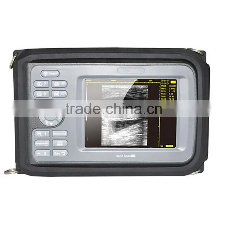 Ultrasonic system 5.5 inch monitor Handheld Ultrasound Machine with 3.5 Mhz Convex probe