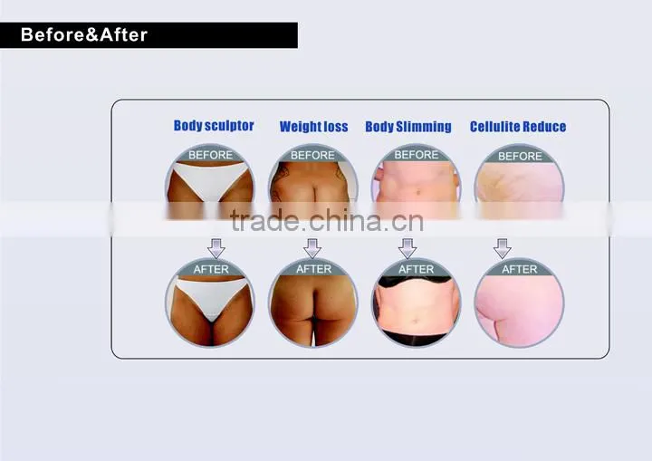 Popular slimming vacuum cavitation rf fat removal, body shaping skin wrinkle cavitation rf machine Sineron-I