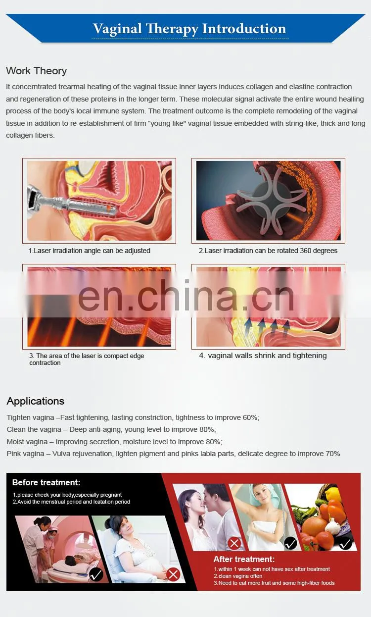 Renlang 4D fractional co2 laser machine for skin rejuvenation Scar removal vaginal tightening