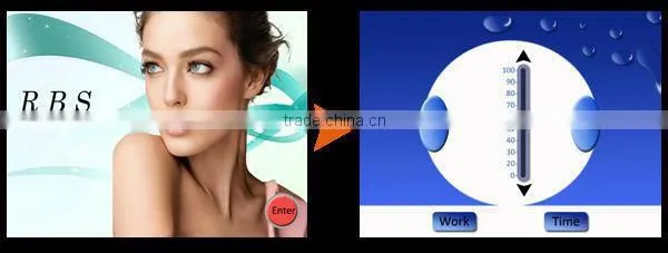 vascular removal spider veins removal