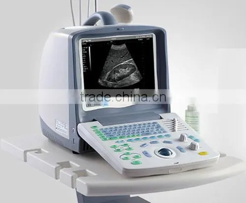 Portable musculoskeletal ultrasound machine