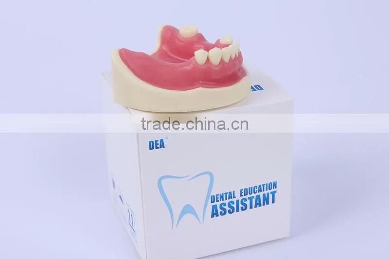 Trade Assurance Hot Dental Implant System CE Approved Dental Implant Model