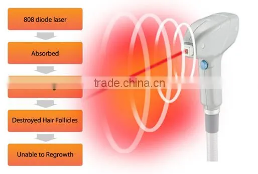 T&B distributor 2000W 808nm diode laser epilation machine