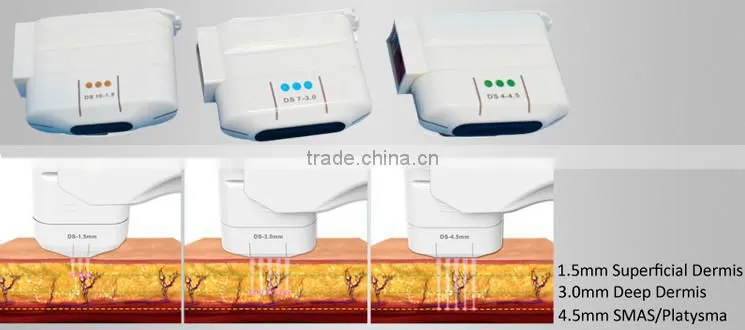 portable no-surgical treatment to tighten sagging skin beauty machine