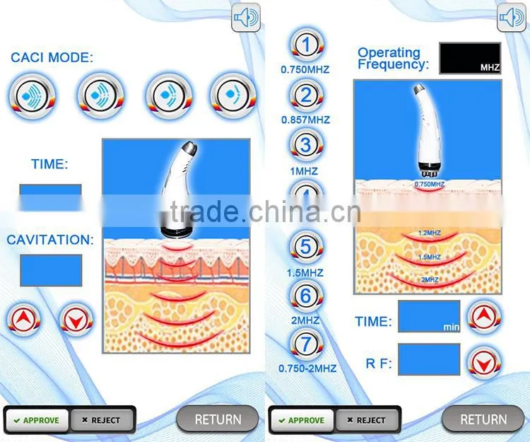 Professional manufacturer fda ultrasonic cavitation