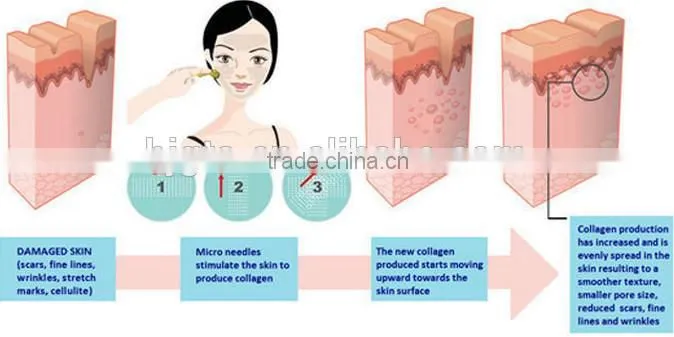 192 micro needle MT derma roller with low price hotsale in the world