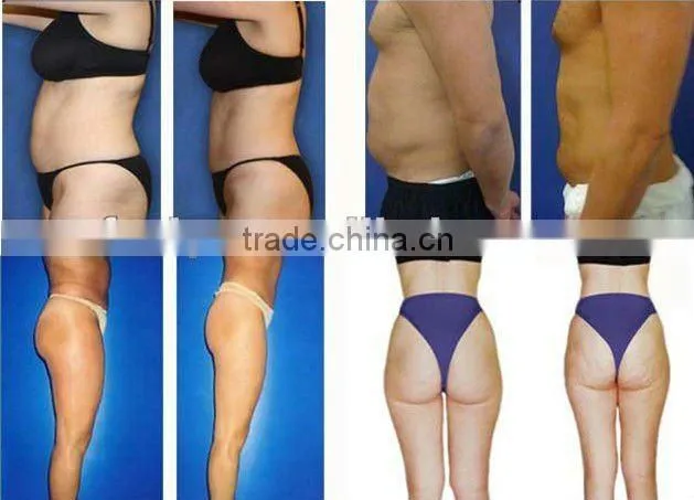 VY-Q2A Fat burning ultrasonic beauty machine shape body