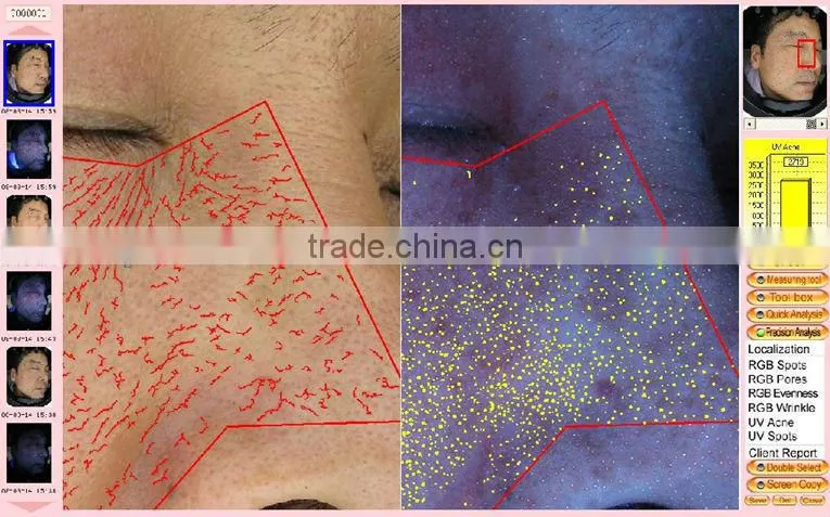 skin analyzer magnifier machine for sale