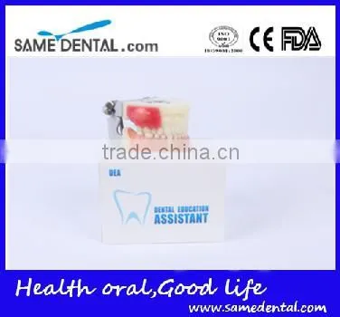 Abscess and tooth preparation model school teaching demonstration