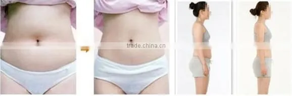 2014 New ultra lipo cavitation+rf beauty slimming machine with CE