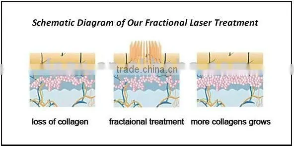 Popular most popular fractional rf dot matrix rf