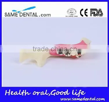 Hemi mandible anatomical model Dental Eduction Assitant No. DEA-18