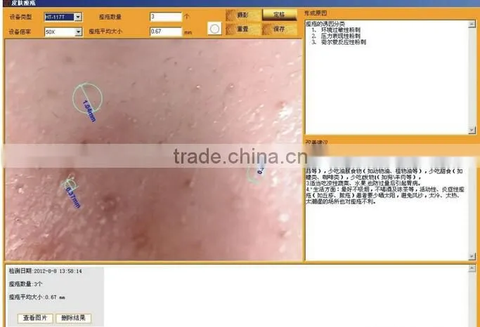 AYJ-J019(CE)portable magic mirror skin analyzer beauty machine new products for 2015 hot with CE