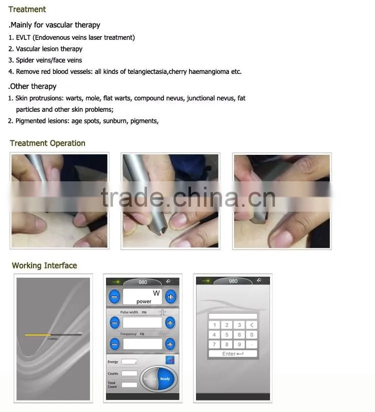 Technology 2016 varicose vein removal 980 vascular therapy machine