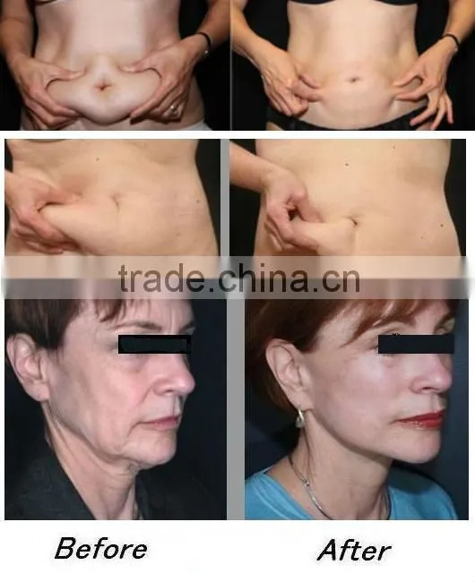 New coming Machine for body slimming IBelle