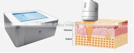 2016 Portable HIFU body Immediate slimming burn fat weight loss professional beauty salon equipment